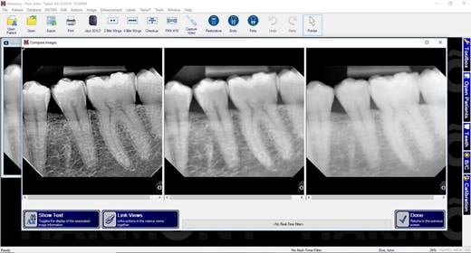 Image-Compare-feature