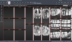Jazz Rx Software Jazz Classic Dental Imaging Software