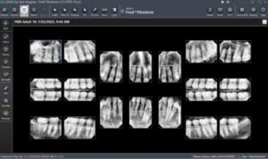Jazz Rx Software Jazz Classic Dental Imaging Software