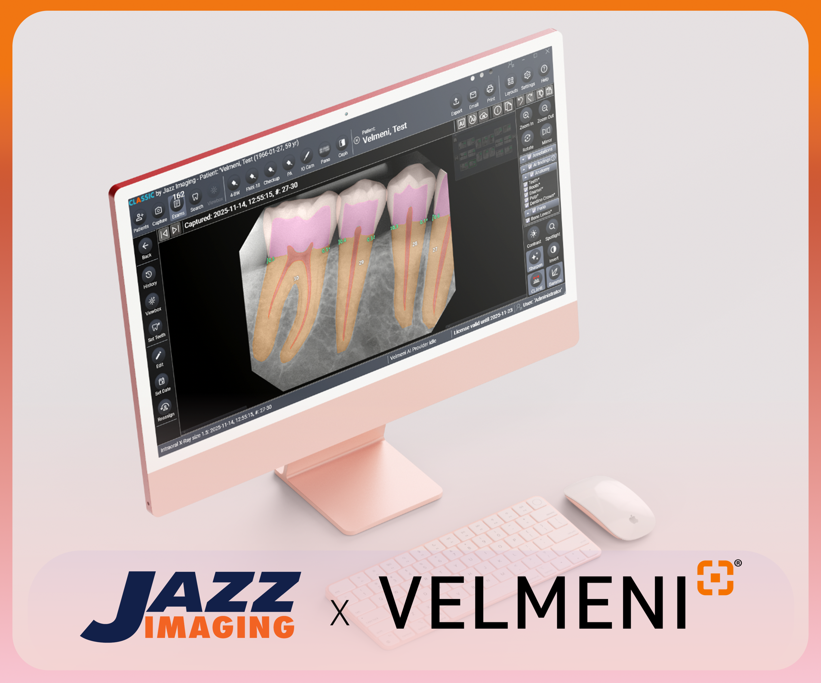 Picture of Jazz Imaging / VELMENI