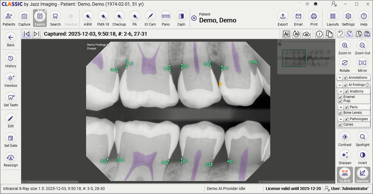 Jazz Rx Software Jazz Classic Dental Imaging Software