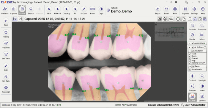 Jazz Rx Software Jazz Classic Dental Imaging Software